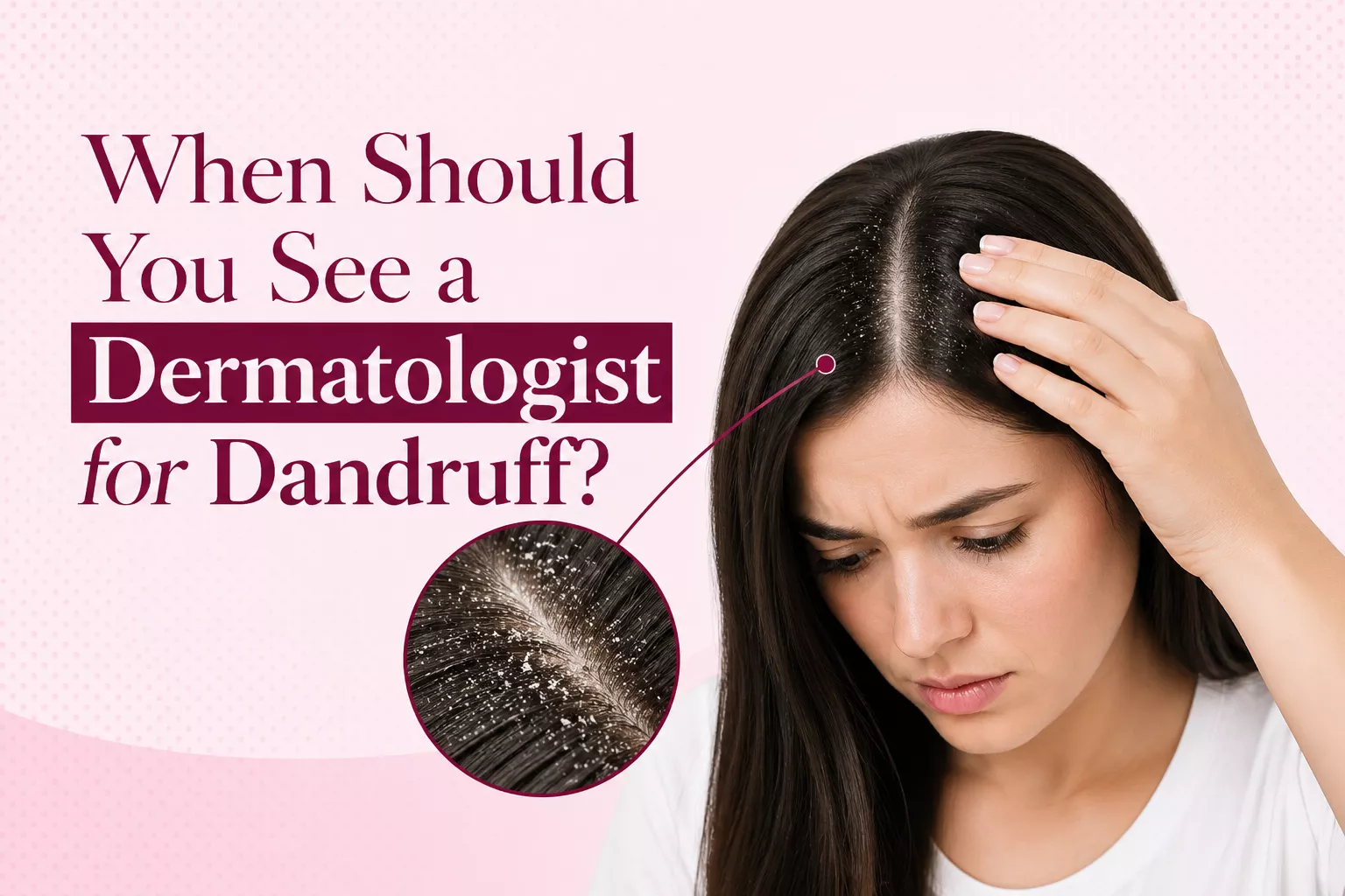 When Should You See a Dermatologist for Dandruff?