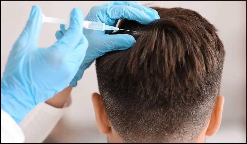 GFC Hair Treatment: Benefits, Side Effects & Cost